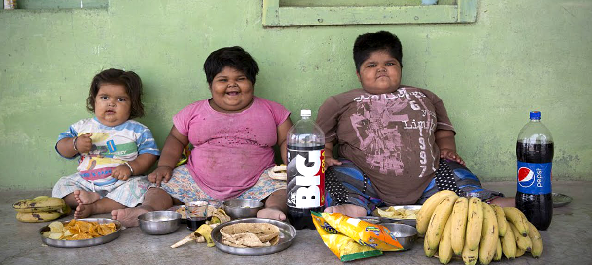 The Food Paradox: An Augmenting Connection Between Obesity and Malnutrition in Developing Countries