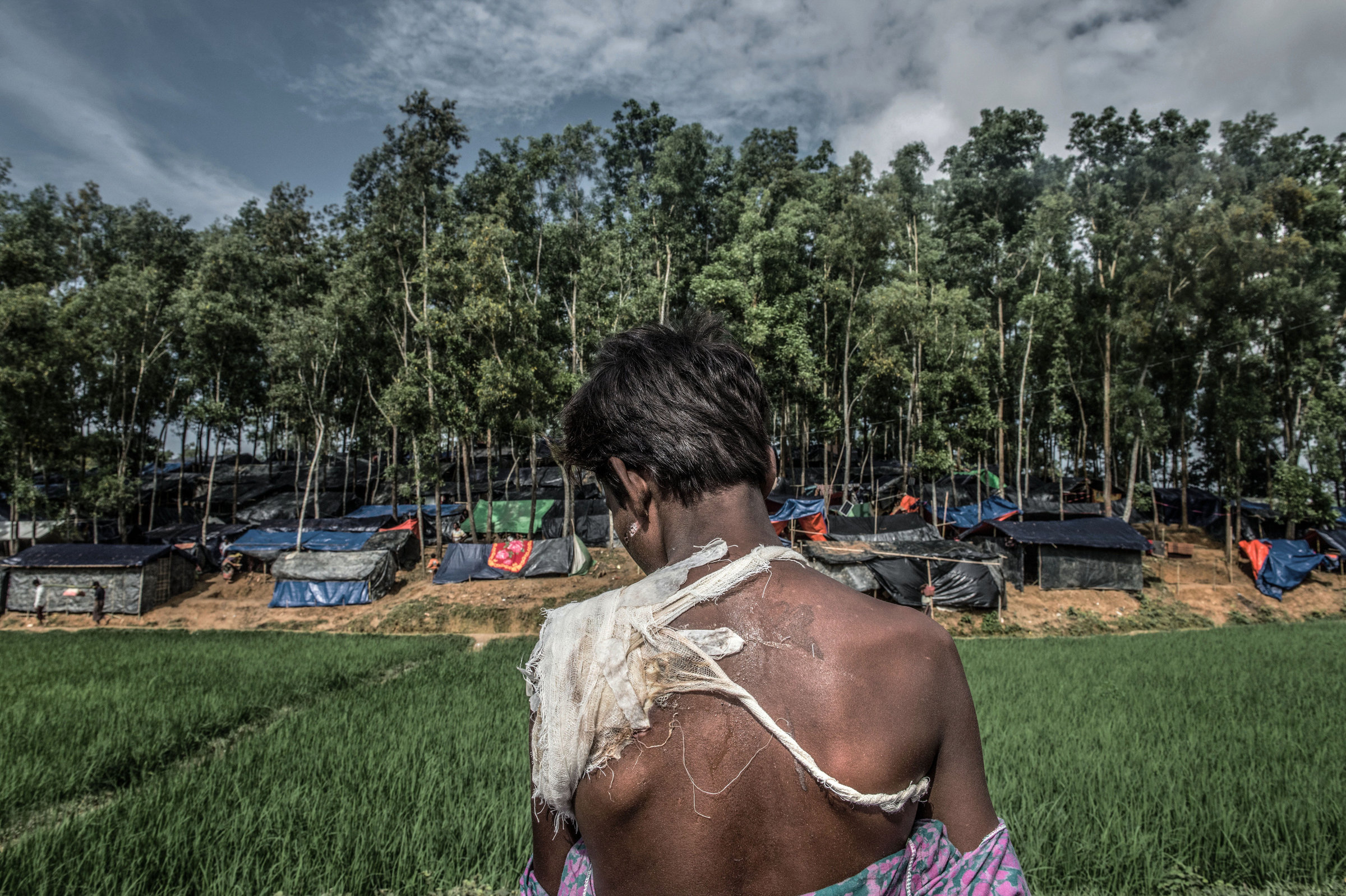 The Injury You Cannot See: The Effects of the Refugee Crisis on the Rohingya Children